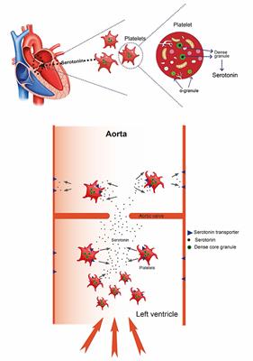 Serotonin—A Driver of Progressive Heart Valve Disease